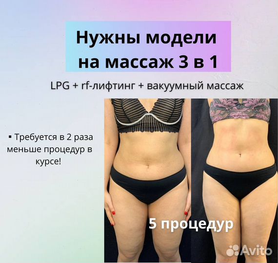 Аппаратный массаж lpg+rf+вакуум модели