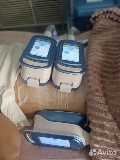 Криолиполиз