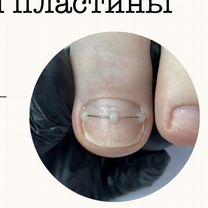 Подолог с выездом на дом, Йошкар-Ола