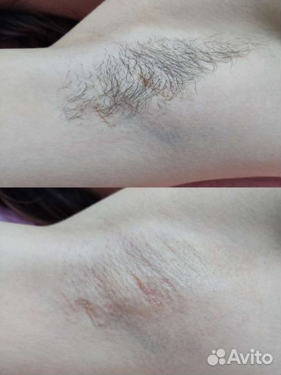 Услуги косметолога