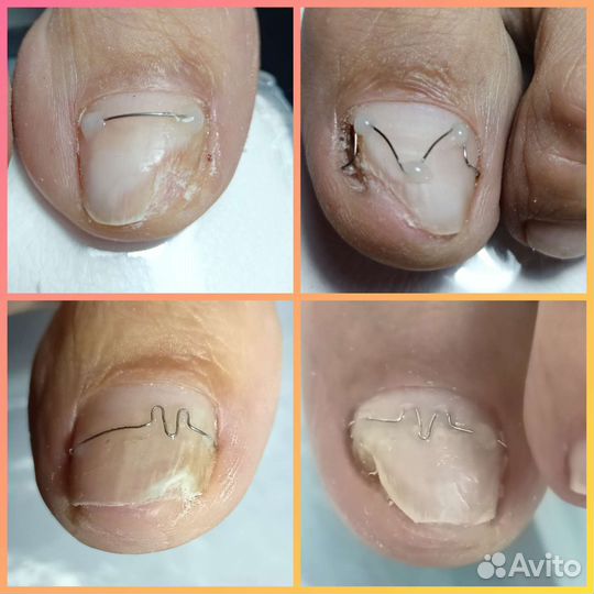 Подолог, Маникюр и педикюр