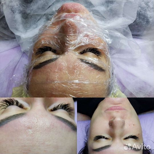 Услуги косметолога