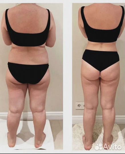 Убрать живот. Удалить жир. Лазерное похудение