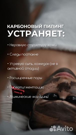 Карбоновый пилинг