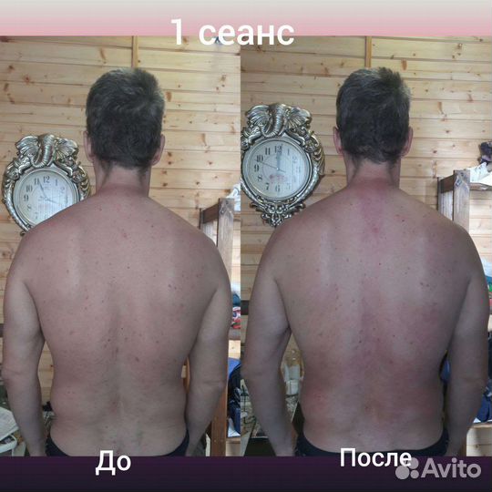 Костоправ. Владимир