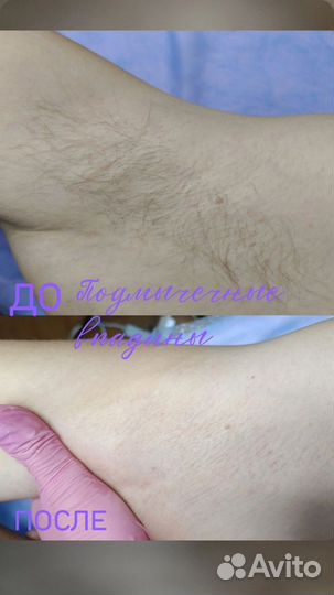 Модель на шугаринг