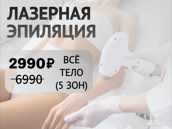 Лазерная эпиляция
