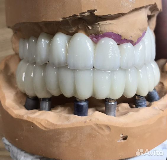 Зубной техник