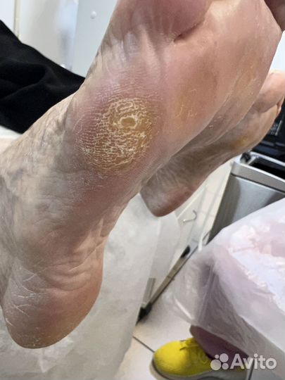 Подолог Бор