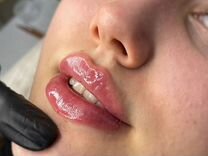 Красивые пухлые губы филлером + лифтинг лица