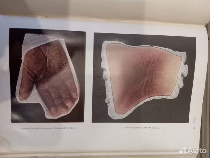 Антикварные книги по медицине