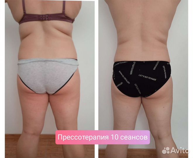 Вакуумный массаж Вибрационный массаж Прессотерапия