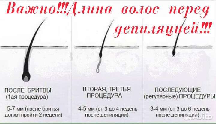 Шугаринг