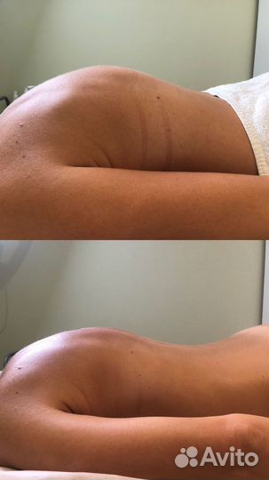 Биоэнергетический массаж