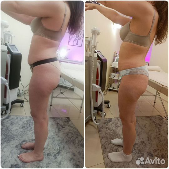 Ищем модель на комплексы массажа и подтяжки