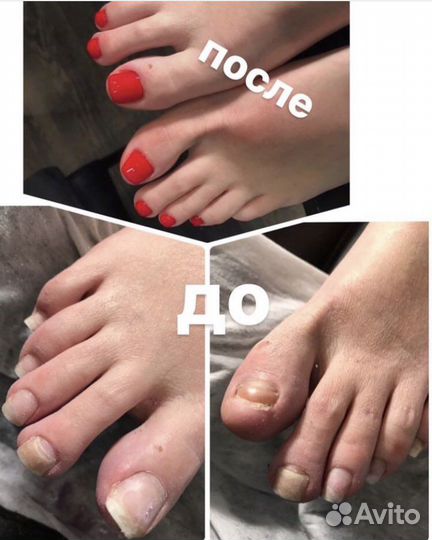 Маникюр с покрытием