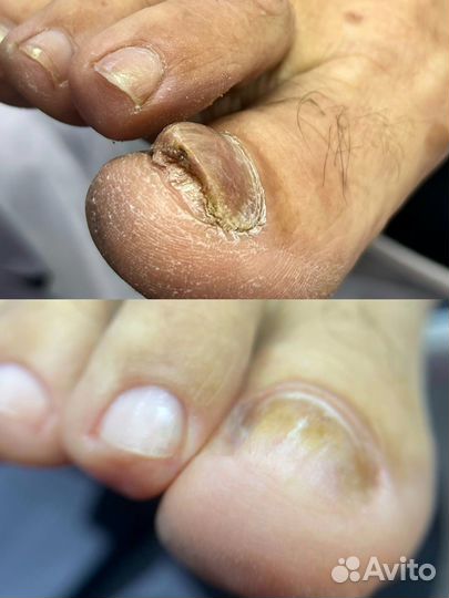 Услуги подолога