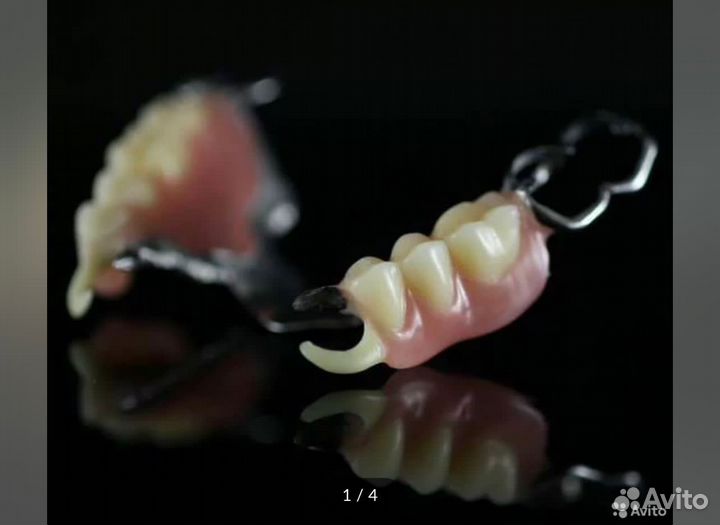 Ремонт зубного протеза от 30 минут