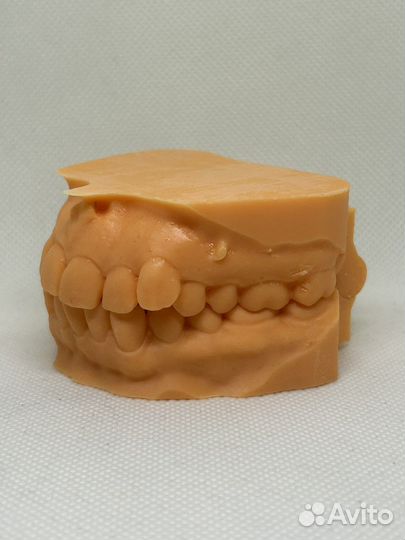 Ортодонтическая 3-D печать