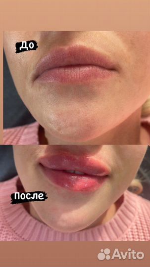 Косметолог с медицинским образованием