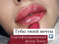 Увеличение губ, носогубка, врач-косметолог
