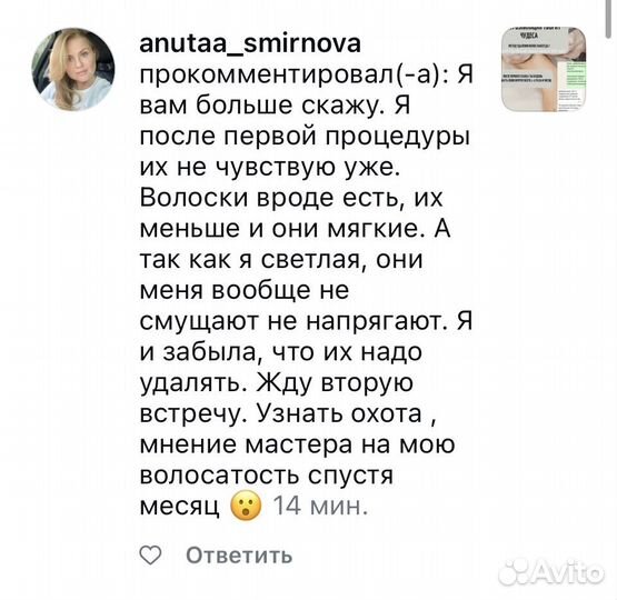 Электроэпиляция