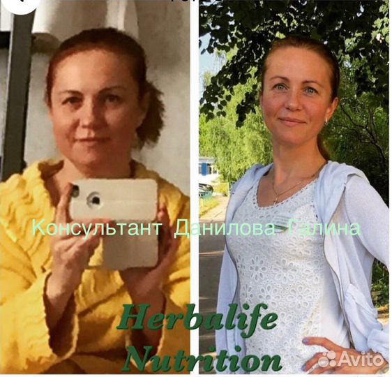 Консультант похудеть Дмитров