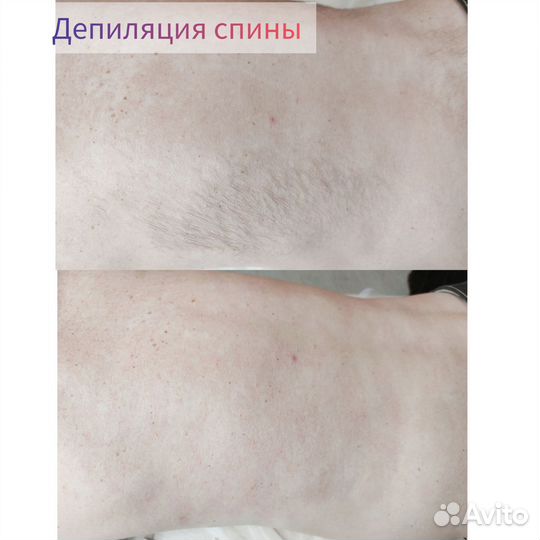 Депиляция/Обучение. Косметология. Кирсанов