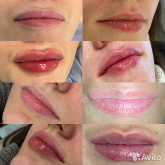 Мужская и женская косметология