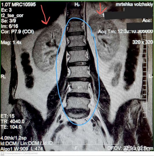 Висцеральный массаж. Правка живота
