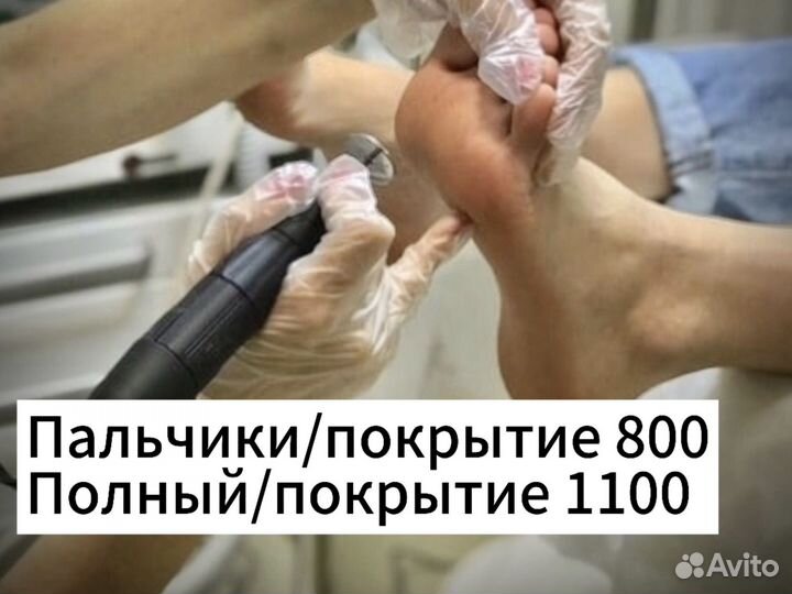 Педикюр в Тюмени