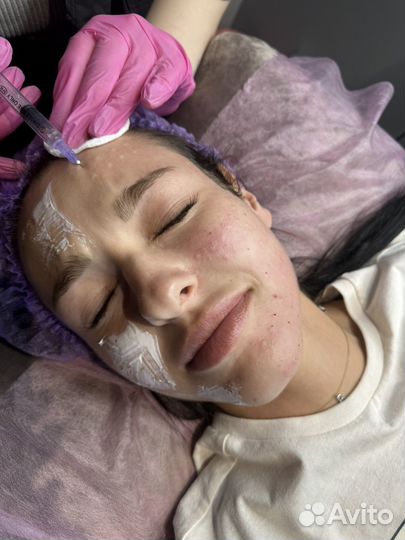 Ботокс лица, биоревитализвция, мезотерапия