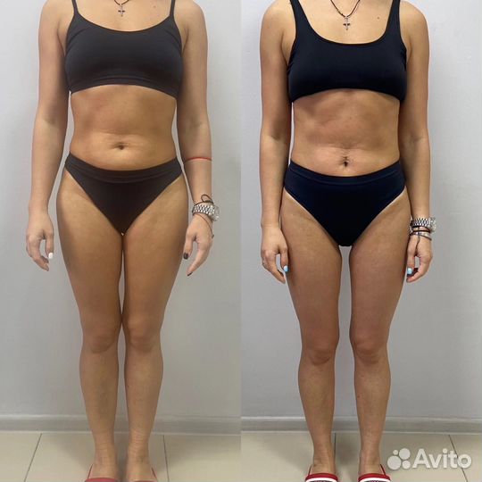 Марафон стройности