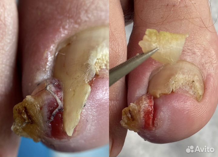 Услуги подолога