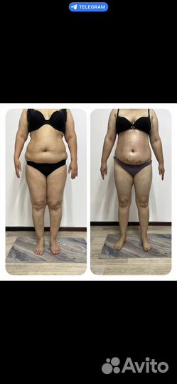 Коррекция фигуры снижение веса