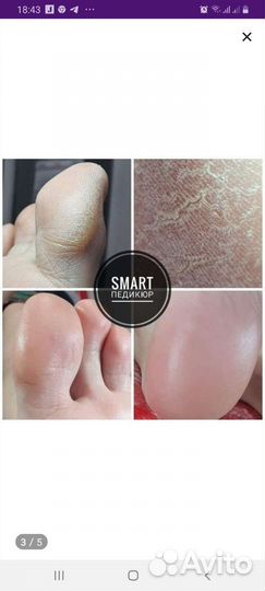 Смарт педикюр