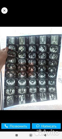 Рентгеновские снимки