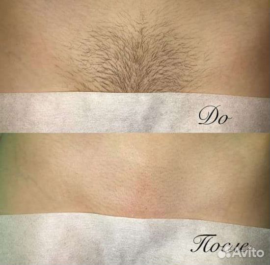 Мастер шугаринга