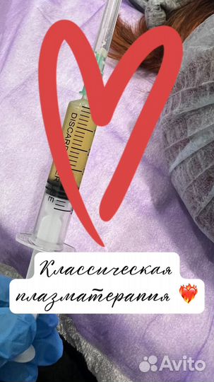 Плазматерапия