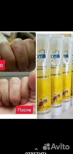 Бесплатно Зубная паста и щетка атоми