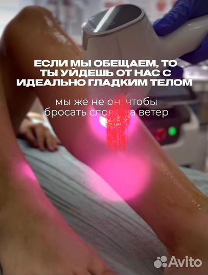 Лазерная эпиляция