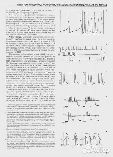 Аритмии и блокады сердца: атлас электрокардиограмм