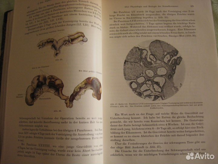 Книга антикварная по медицине гинекология 1929 год