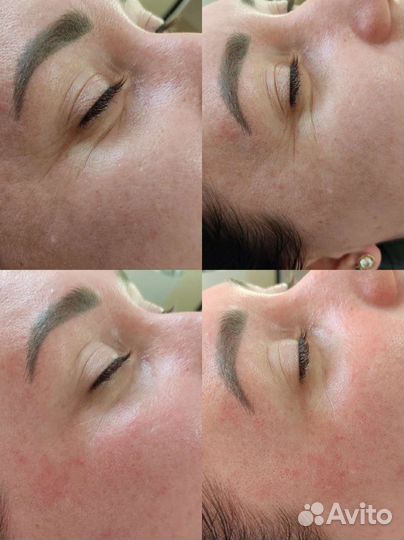 Аппаратная коррекция фигуры/ручной массаж