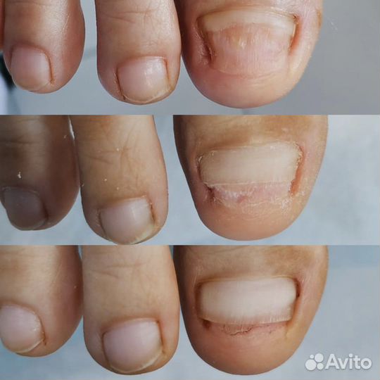 Услуги подолога