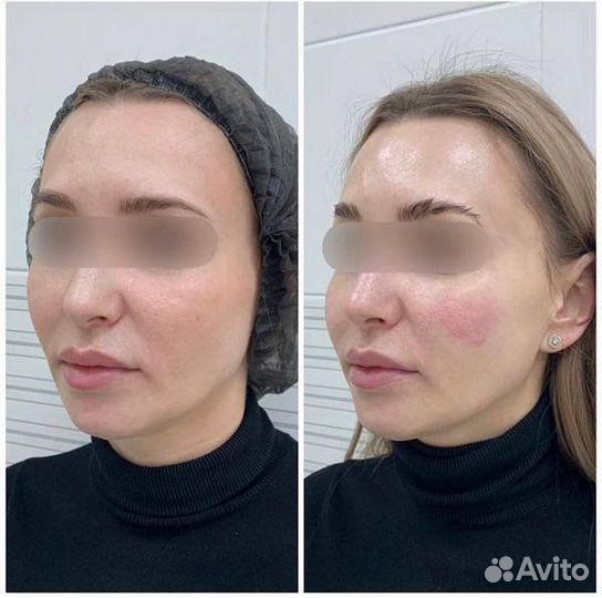 Требуется модель на Альтера