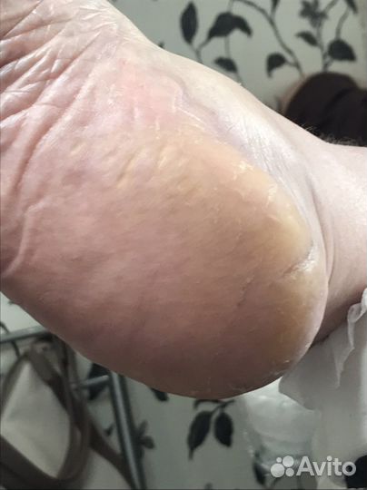 Услуги подолога