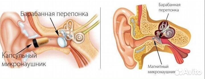 Микронаушник в аренду