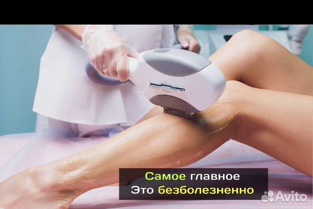 Лазерная эпиляция