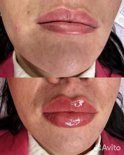 Нужны Модели косметологу